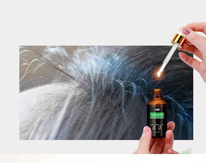 Talent Hair Growth Repair Hair Follicle Essential Oil - Zambeel