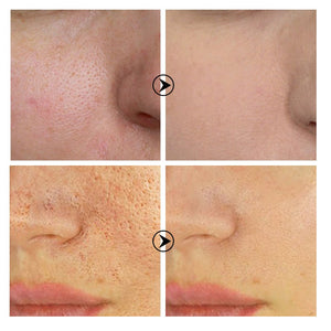 Tea tree pore shrinking serum - Zambeel