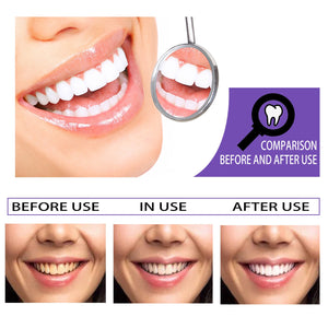 Teeth Whitening Toothpaste Whitening Teeth Removal - Zambeel