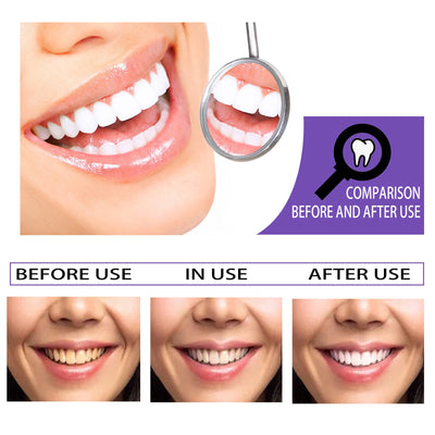 Teeth Whitening Toothpaste Whitening Teeth Removal - Zambeel