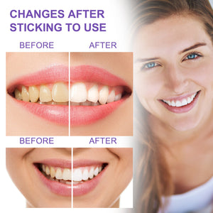 Teeth Whitening Toothpaste Whitening Teeth Removal - Zambeel