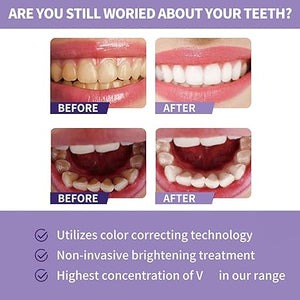 Toothpaste for Teeth Whitening (30ml) - Zambeel