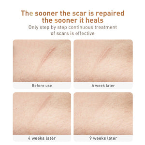 Traditional Chinese Medicine Scar Removal Cream Care Cream Skin Care Products - Zambeel