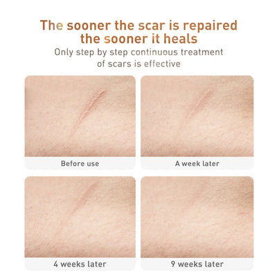 Traditional Chinese Medicine Scar Removal Cream Care Cream Skin Care Products - Zambeel