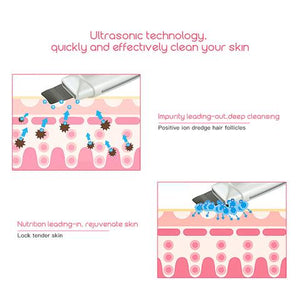 Ultrasonic Skin Scrubber Face Cleanser Blackhead Acne Removal Facial Spa Vibration Massager Ultrasound Peeling Clean Machine 394 - Zambeel