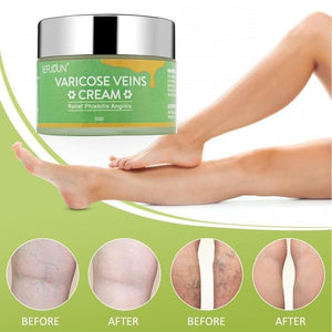 Vein Cream Red Blood Streaks Repair Earthworm Leg Bruises Bulge Relief Pain Safflower Skin care lotion Varicose Cream - Zambeel