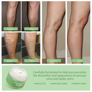 Vein Cream Red Blood Streaks Repair Earthworm Leg Bruises Bulge Relief Pain Safflower Skin care lotion Varicose Cream - Zambeel
