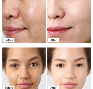 Vibrant Glamour - Retinol Cream - Zambeel