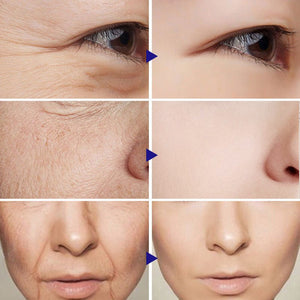 Vitamin C Serum Facial Serum Amazon - Zambeel