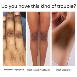 Women's Skin Pigmentation Care - Zambeel