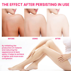 Women's Skin Pigmentation Care - Zambeel